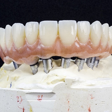 Model of implant-retained dentures on ceramic base